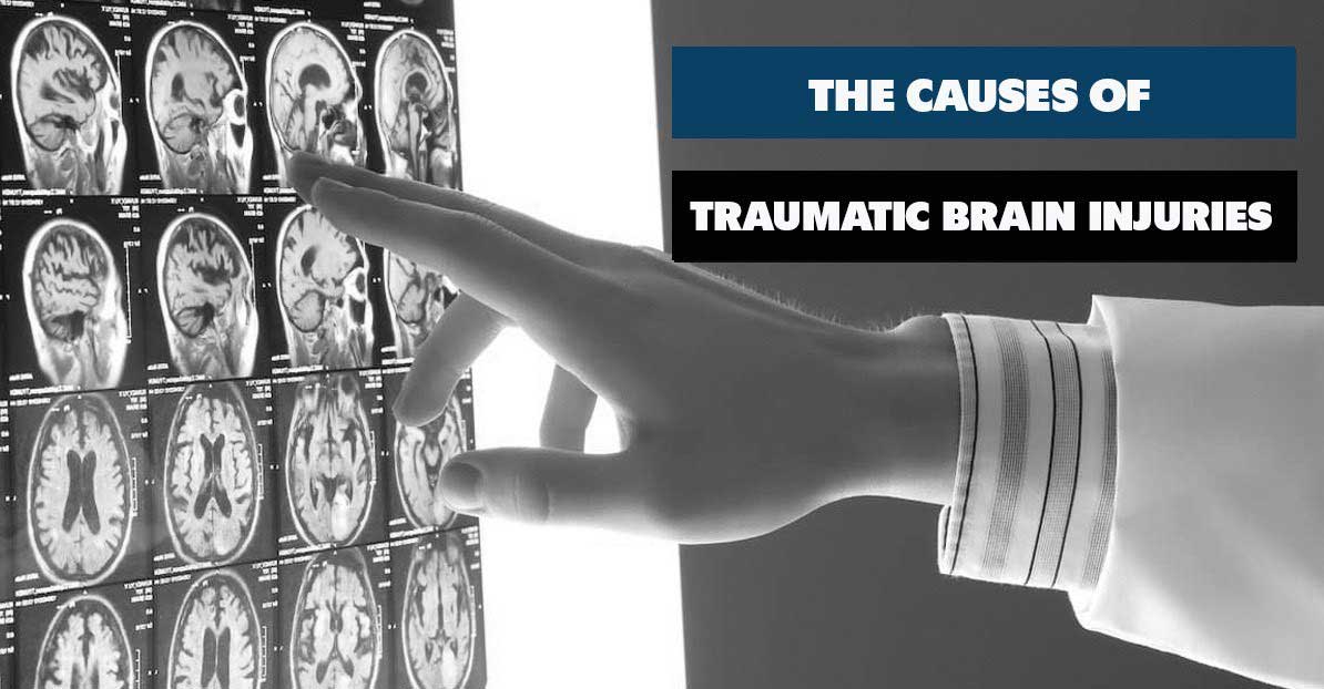 The Causes Of Traumatic Brain Injury O Connor Partners PLLC